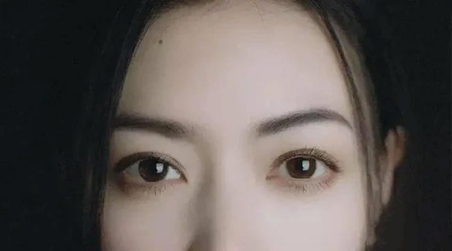 Nốt ruồi ở 4 vị trí này trên mặt ảnh hưởng nhiều đến sự nghiệp mà chẳng mấy người biết, vị trí số 3 hao hụt tài lộc thấy rõ-1