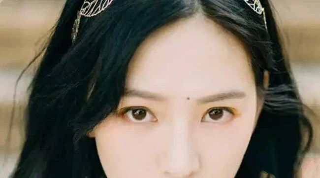 Nốt ruồi ở 4 vị trí này trên mặt ảnh hưởng nhiều đến sự nghiệp mà chẳng mấy người biết, vị trí số 3 hao hụt tài lộc thấy rõ-3