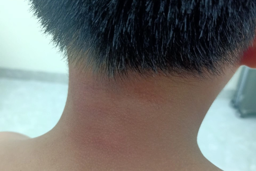 Người phụ nữ báo công an sau cả chục năm 3 mẹ con chịu đòn chồng-1