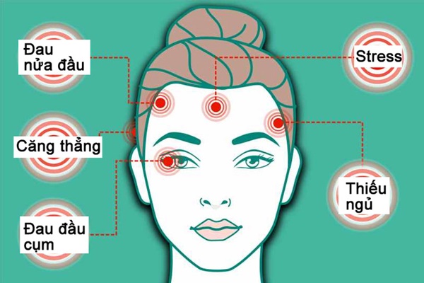 Từng vị trí đau đầu cảnh báo bất ổn sức khỏe khác nhau-1