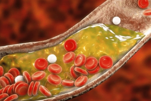 5 loại rau củ đánh bay mỡ máu có hại, chợ Việt có sẵn nhưng nhiều người chưa biết để ăn-5