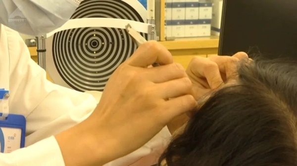 Dụi mắt vì khó chịu, người phụ nữ ớn lạnh khi thấy vật thể rơi ra, hơn 60 con giun còn sống ký sinh trong mắt-1