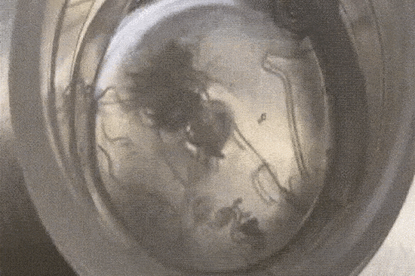 Dụi mắt vì khó chịu, người phụ nữ ớn lạnh khi thấy vật thể rơi ra, hơn 60 con giun còn sống ký sinh trong mắt-2