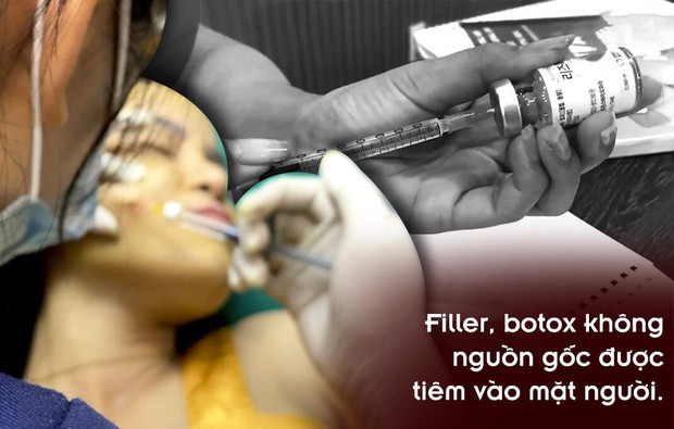 Góc tối thị trường filler xịn”: Hàng rải bán trên đường dùng tiêm vào mặt người-7