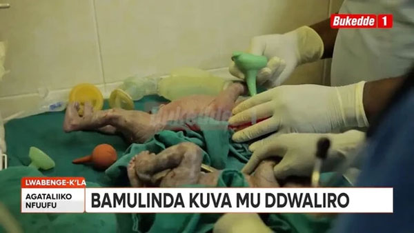 Mang thai ở tuổi 70, bà lão sinh đôi một trai, một gái-1