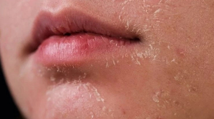 Sai lầm thường gặp khi chăm sóc da mùa đông-1