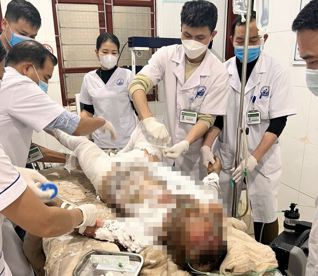 Người đàn ông tự thiêu vì mâu thuẫn với vợ-1