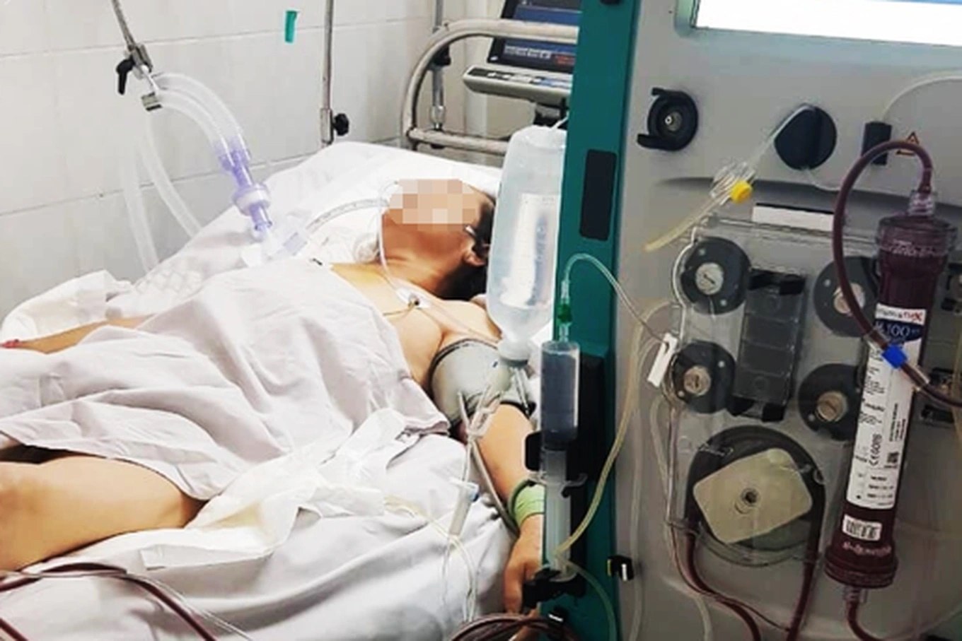 Một gia đình có 7 thành viên bị tiểu đường: Người mất, kẻ phải cắt chân-2