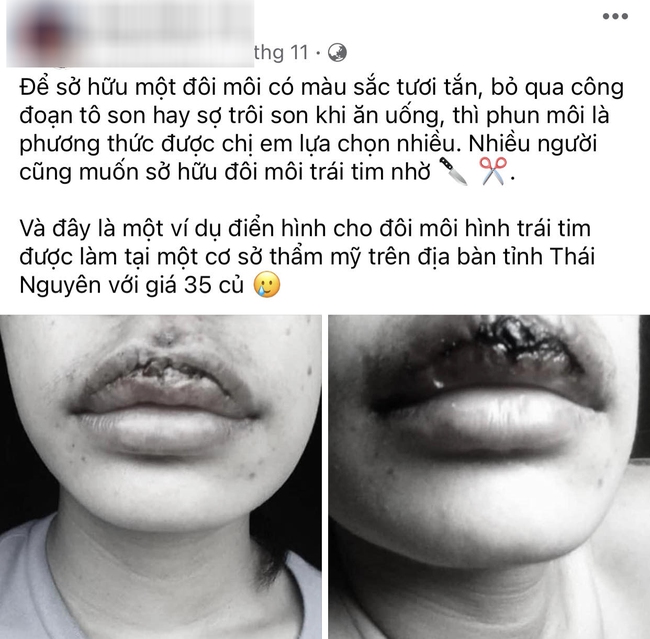 Chi 35 triệu phun môi trái tim, sản phẩm nhận về khiến ai nhìn thấy cũng hốt hoảng-1