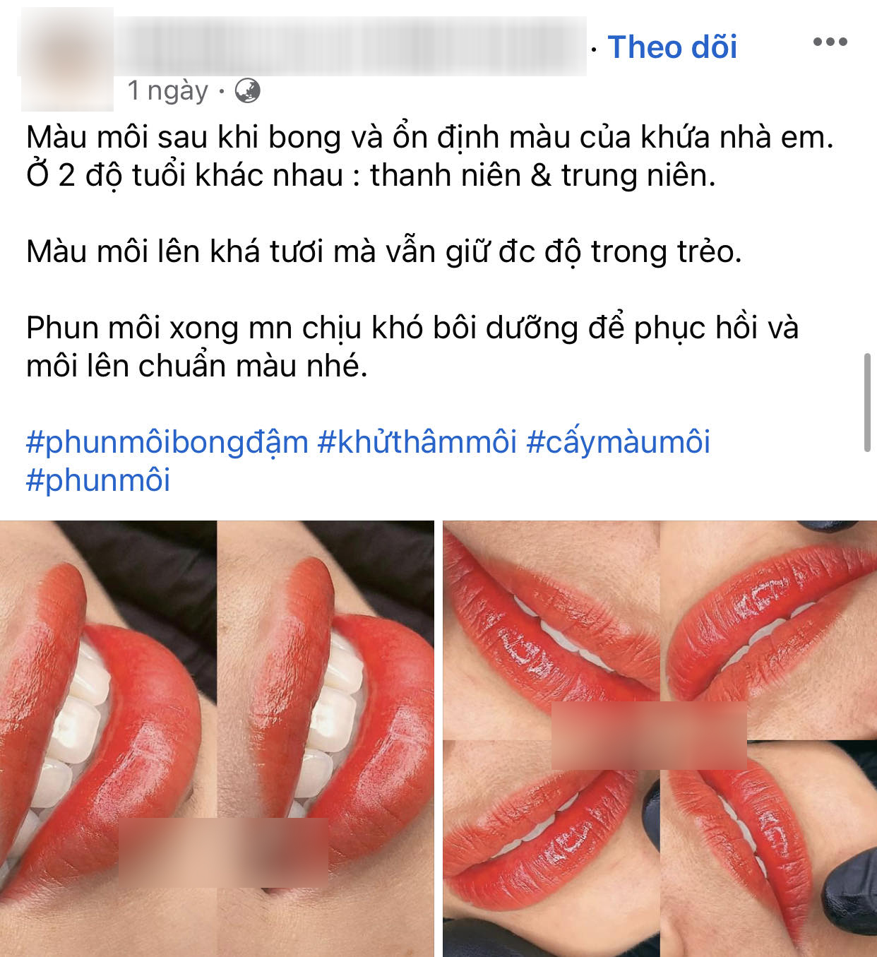 Chi 35 triệu phun môi trái tim, sản phẩm nhận về khiến ai nhìn thấy cũng hốt hoảng-2