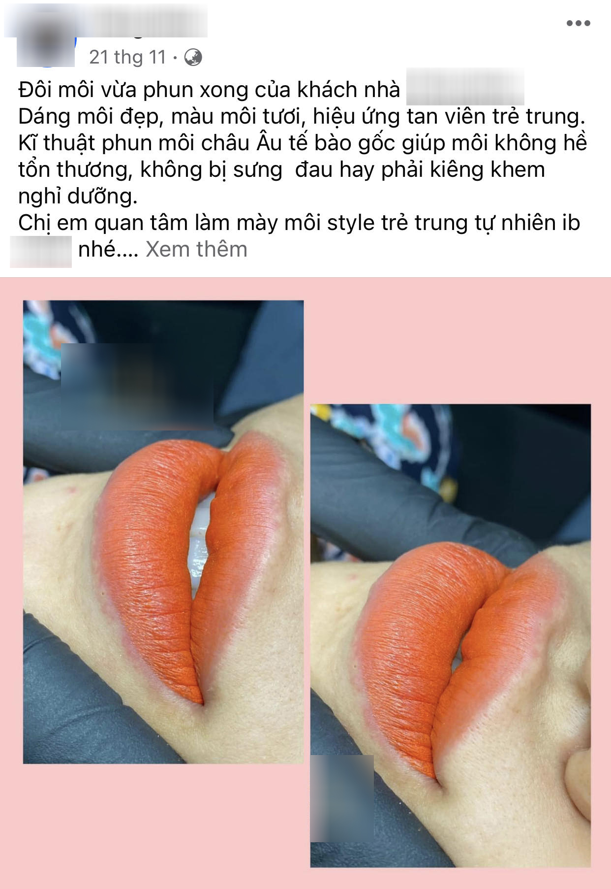 Chi 35 triệu phun môi trái tim, sản phẩm nhận về khiến ai nhìn thấy cũng hốt hoảng-3