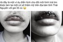 Chi 35 triệu phun môi trái tim, 'sản phẩm' nhận về khiến ai nhìn thấy cũng 'hốt hoảng'