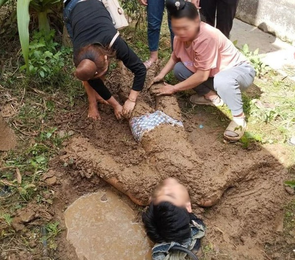 Em lao vào cứu anh trai bị điện giật, cả 2 bị thương nặng-1