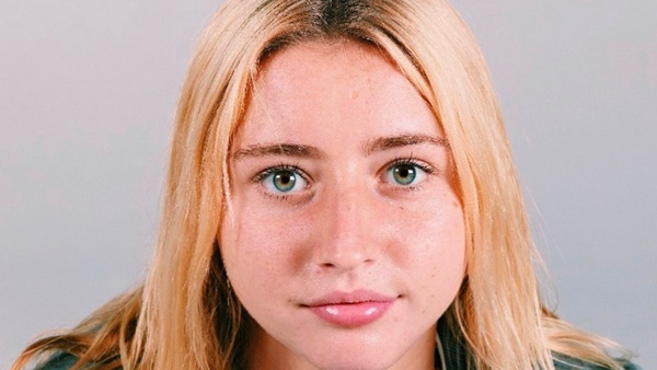 Nữ sinh phát hiện suy thận ở tuổi 20, chức năng thận chỉ còn 15%: 4 dấu hiệu rất dễ bị bỏ qua-1