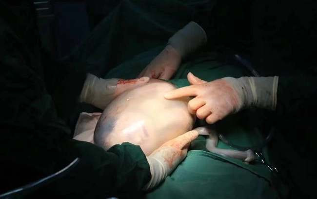 Sinh con còn nguyên trong túi ối, vợ tổn thương vì chồng buột miệng nói 1 câu-1