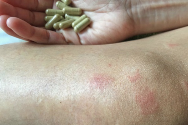 Sự nguy hiểm của căn bệnh nữ minh tinh Châu Hải My phải chịu đựng suốt 20 năm-1