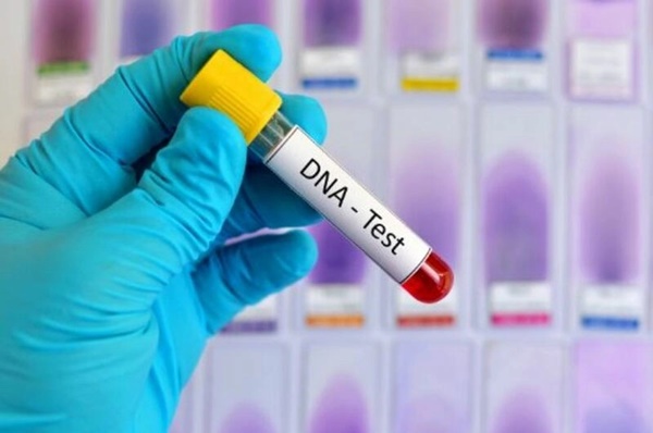 Gần Tết đưa người yêu về ra mắt, cô gái sững sờ khi bố mẹ đòi đưa bạn trai đi làm xét nghiệm ADN-3