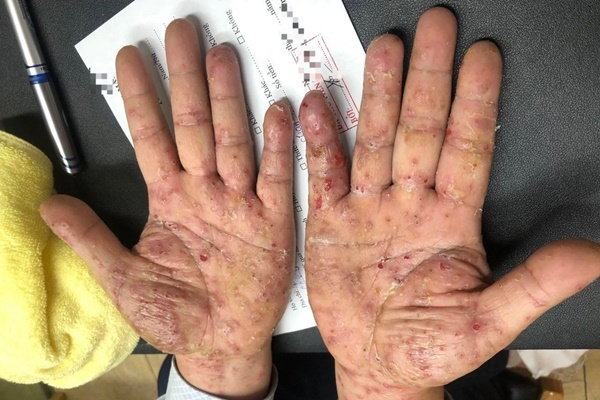 Hà Nội: Cả nhà ngứa ngáy sau chuyến công tác của bố-1