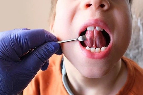 Góc khuất sau việc cắt thắng lưỡi cho bé sơ sinh: Từ thủ thuật nhỏ giúp trẻ bú mẹ thành món lợi cho những người lợi dụng lòng tin-4