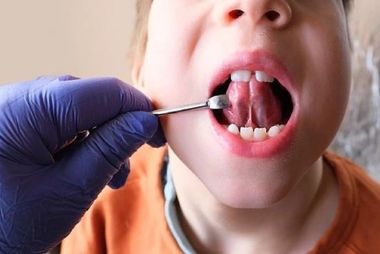 Góc khuất sau việc 
