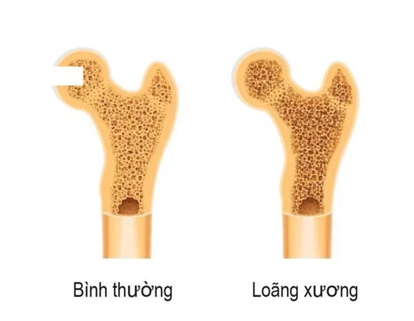 Thói quen nấu nướng nhiều người mắc đang rút cạn xương trong cơ thể bạn-1