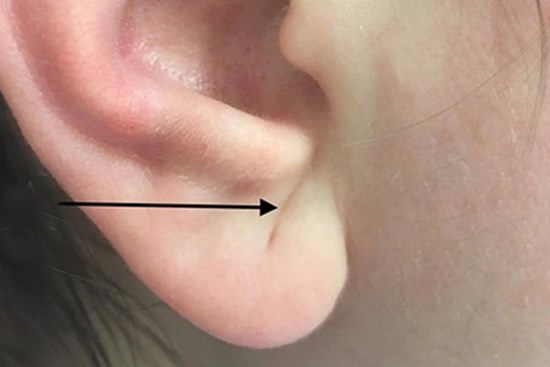 3 bất thường ai cũng tưởng vấn đề da liễu nhưng thực chất đang cố vạch trần bệnh tim