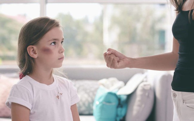 Hậu quả từ việc dùng nắm đấm dạy con-1