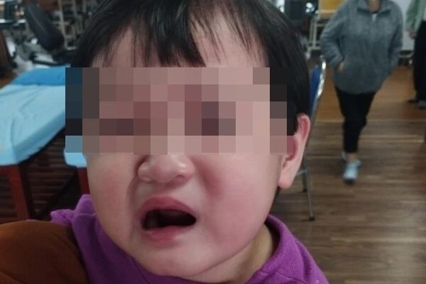 Bé 2 tuổi bị méo miệng vì đi chơi buổi tối lạnh-1