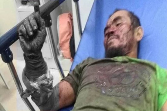 Tấn công nhầm đối thủ, con trăn lớn bị người đàn ông cắn đứt cổ, chết tại chỗ