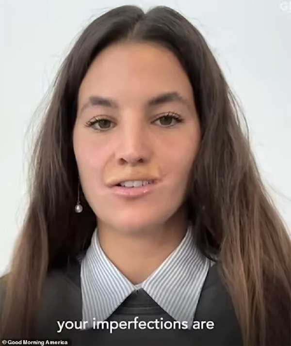 Nữ người mẫu bị chó dữ cắn mất môi trên và hành trình chữa lành gây cảm phục-1