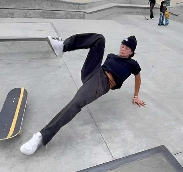 Nữ người mẫu bị chó dữ cắn mất môi trên và hành trình chữa lành gây cảm phục-5