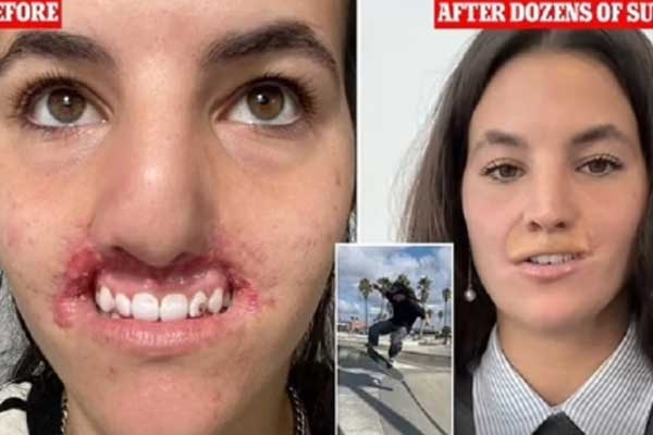 Bị hút vào đoàn tàu cao tốc khi đang chụp ảnh, nữ người mẫu chết thương tâm-3