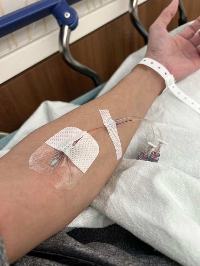 Ca sĩ Kasim Hoàng Vũ phải cấp cứu vì bị nhiễm trùng, sưng mặt và cổ-1