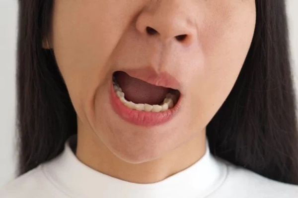 Cảnh giác với bệnh liệt mặt, méo miệng mùa lạnh-1