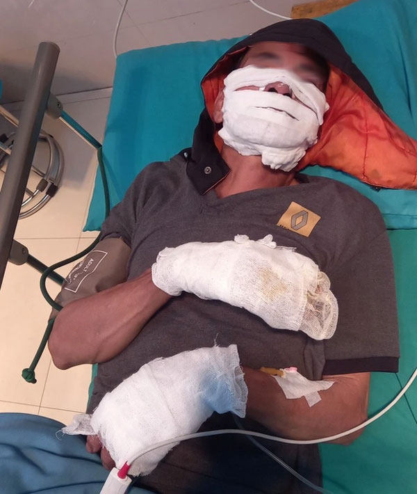 Điện thoại sạc qua đêm phát nổ khiến hai người bỏng nặng-1