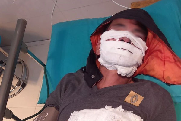 Người phụ nữ bốc cháy như đuốc trước khu nhà trọ ở Bình Dương-2