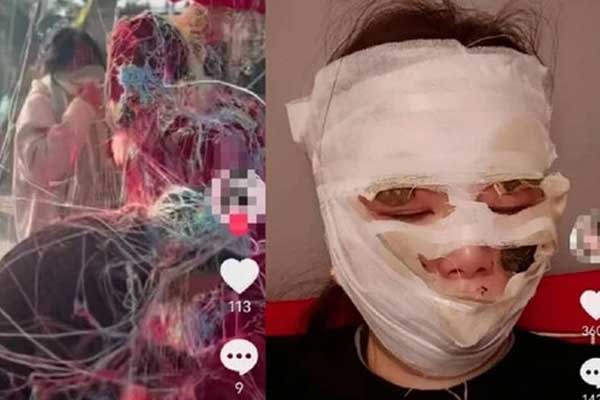 Bình xịt dây đám cưới bốc lửa khiến cô dâu bỏng mặt-1