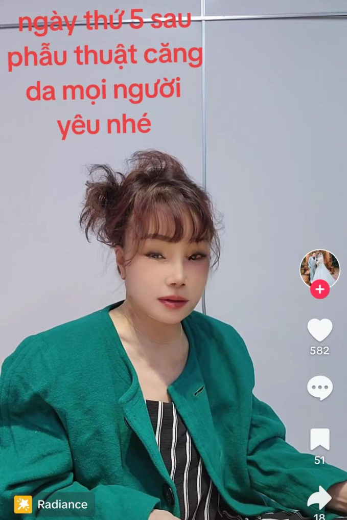 Cô dâu 62 tuổi Thu Sao lộ ngoại hình khác lạ sau khi phẫu thuật căng da mặt níu giữ tuổi xuân, tiết lộ thái độ của chồng trẻ-3