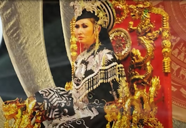 NSƯT cải lương: Bị tai nạn, phải phẫu thuật não và suýt phải sống thực vật-1