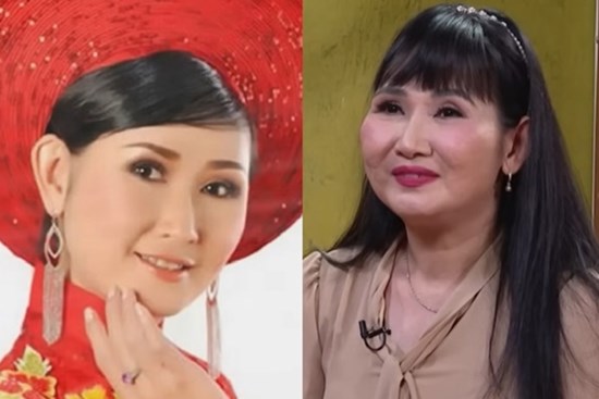 NSƯT cải lương: Bị tai nạn, phải phẫu thuật não và suýt phải sống thực vật