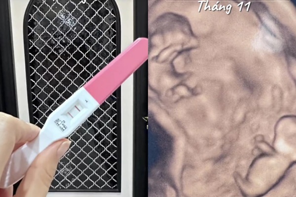 Phương Oanh tiết lộ hình siêu âm song thai, khoe một năm viên mãn khiến netizen ghen tị-1