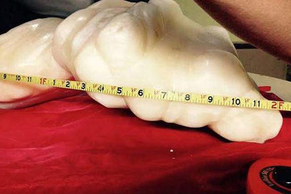 Báu vật” thường dạt vào bờ biển, trông như hòn đá nhưng có giá đắt hơn vàng-5