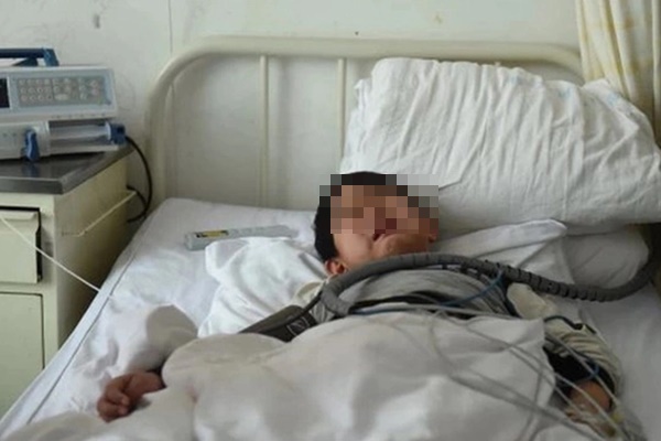 Bất ngờ phát hiện 5000 ký sinh trùng trong người, đã ăn phổi và não khi đi khám xương khớp-2