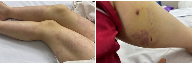 Vừa xuống máy bay, người phụ nữ phải nhập viện khẩn-1