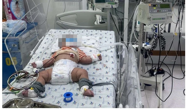 Bé trai 6 tháng tuổi bị tổn thương gan nặng sau 4 ngày sốt-1