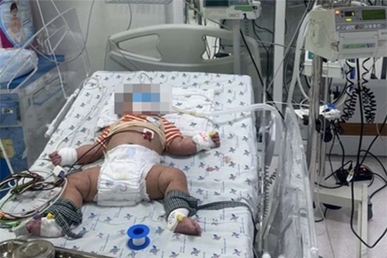 Bé trai 6 tháng tuổi bị tổn thương gan nặng sau 4 ngày sốt