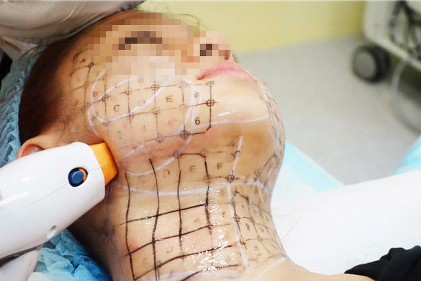 Lại phát hiện nhiều cơ sở ở TPHCM can thiệp vào cơ thể người trái phép-1