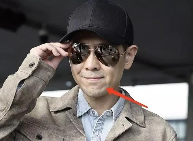 Xót xa hình ảnh Lâm Chí Dĩnh lộ khuôn mặt lồi lõm sau tai nạn xe nghiêm trọng-4