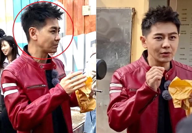 Xót xa hình ảnh Lâm Chí Dĩnh lộ khuôn mặt lồi lõm sau tai nạn xe nghiêm trọng-2