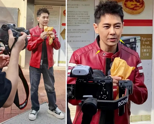 Xót xa hình ảnh Lâm Chí Dĩnh lộ khuôn mặt lồi lõm sau tai nạn xe nghiêm trọng-1